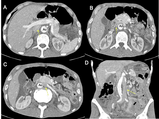 annals-medical-abdominal