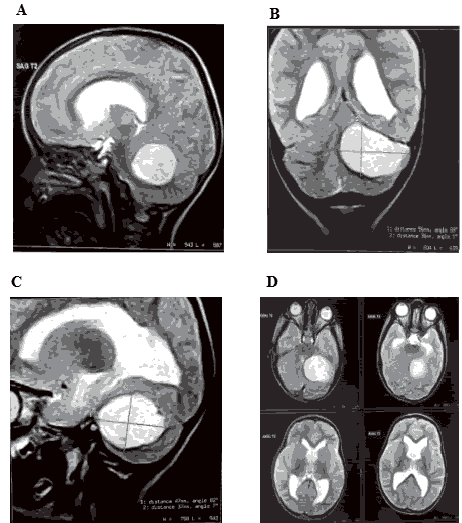 annals-medical-brain