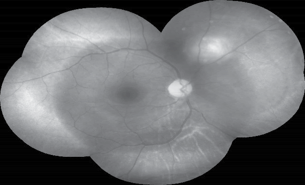 annals-medical-fluorescein