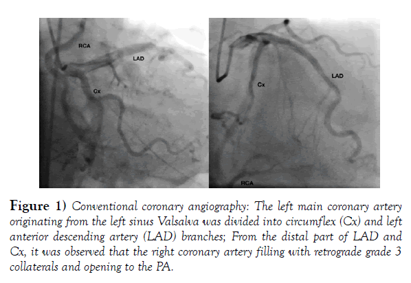 international-journal-anatomical-variations-angiography