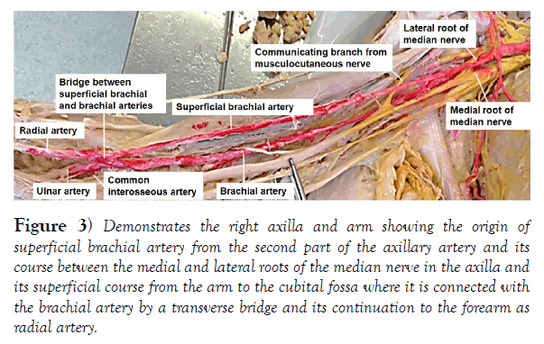 international-journal-anatomical-variations-course