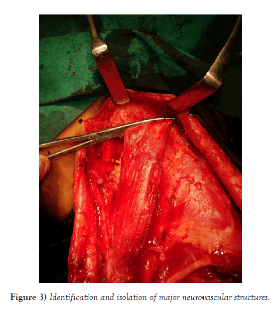 international-journal-anatomical-variations-isolation