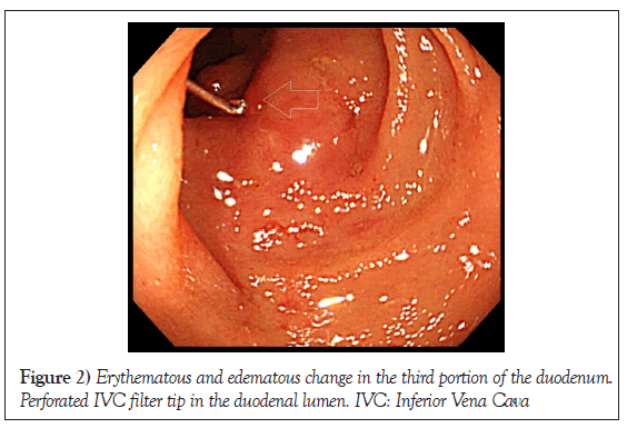 Erythematous