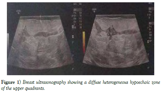 surgery-case-report-breast-ultrasonography