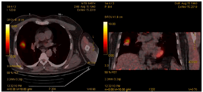 clinical-cardiology-FDG