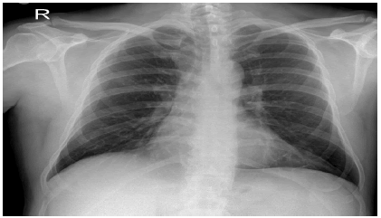 clinical-cardiology-pathological