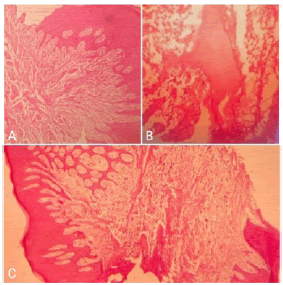 puldcr-epithelium