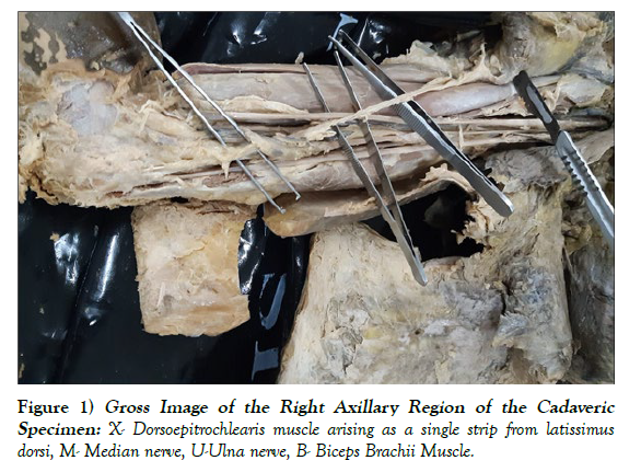 international-journal-anatomical-variations-Gross