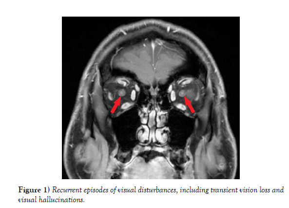 international-journal-anatomical-variations-Recurrent