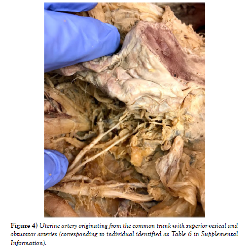 international-journal-anatomical-variations-Uterine