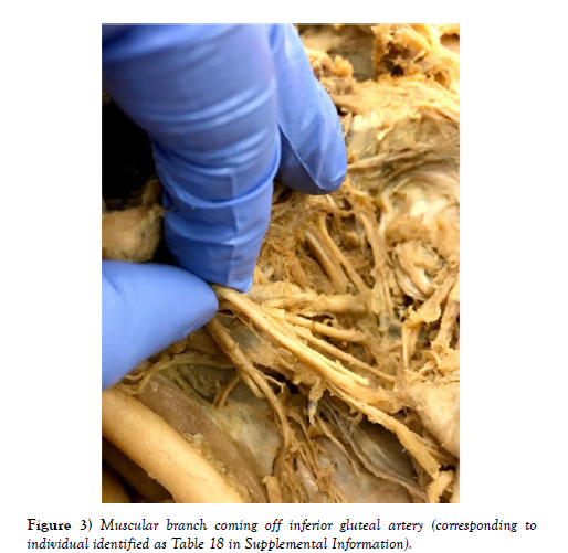 international-journal-anatomical-variations-branch