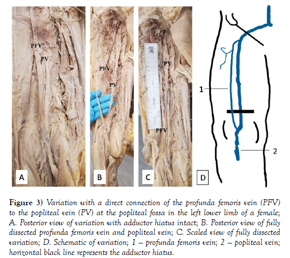 international-journal-anatomical-variations-direct