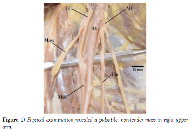 international-journal-anatomical-variations-examination