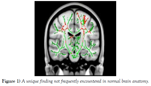 international-journal-anatomical-variations-finding