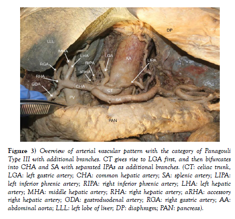 international-journal-anatomical-variations-arterial