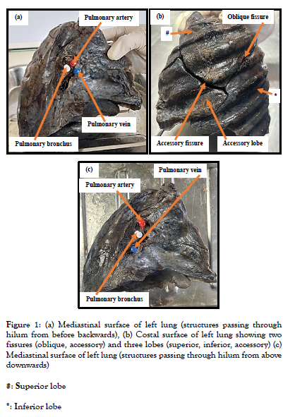 international-journal-anatomical-variations-surface