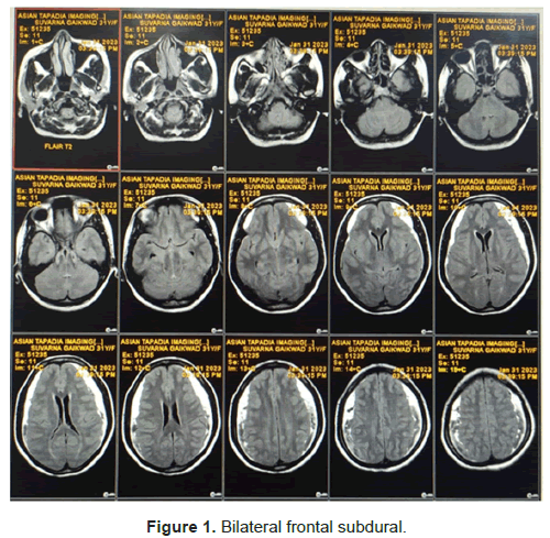 medical-health-bilateral