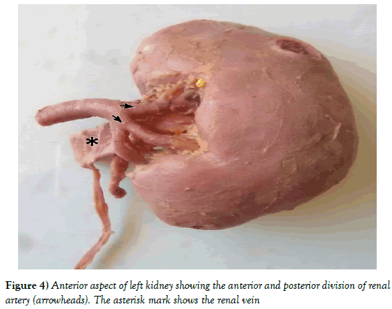 Anatomical-Variations-anterior-posterior-division