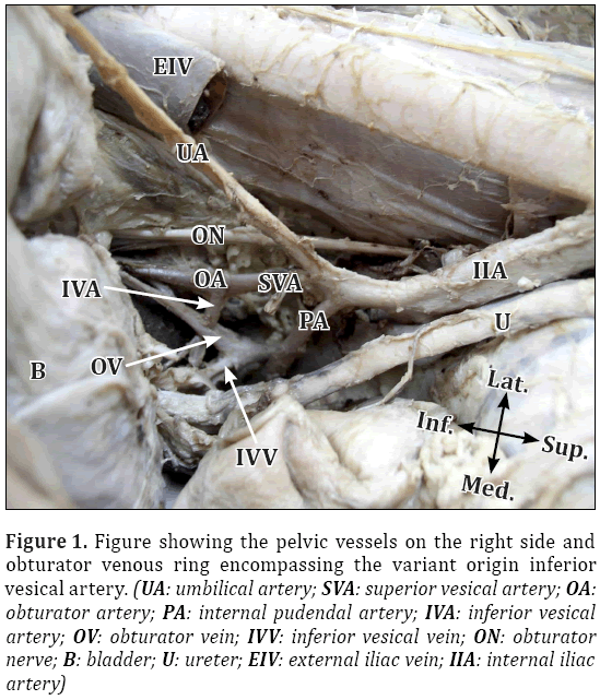 common iliac artery cadaver
