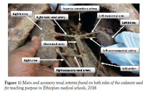 anatomical-variations-accessory-renal