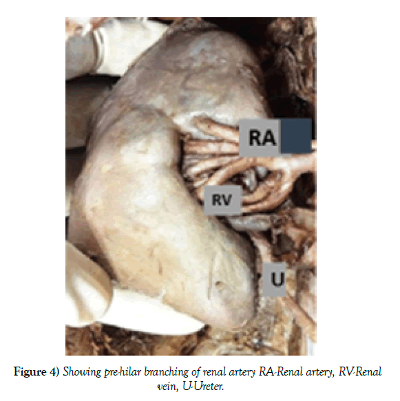 anatomical-variations-branching