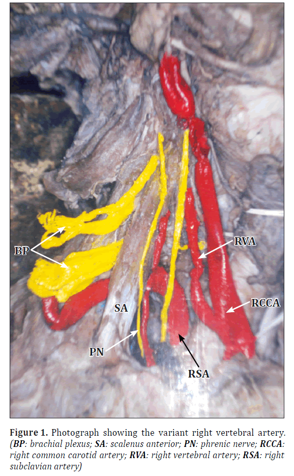 anatomical-variations-scalenus-anterior