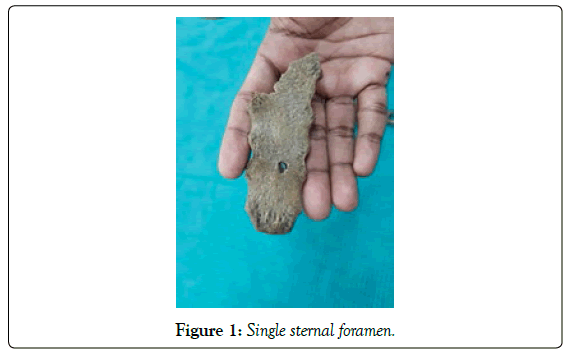 anatomical-variations-sternal-foramen