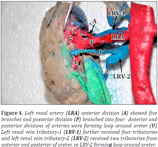 anatomical-variations-superior-polar