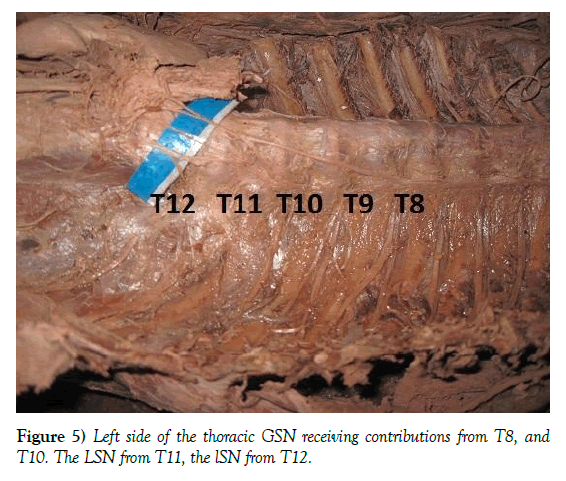 anatomical-variations-thoracic-GSN