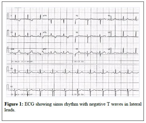 anesthesiology-ECG-showing