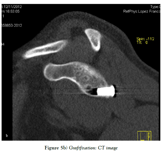 cinical-diagnosis-treatment-graft-fixation