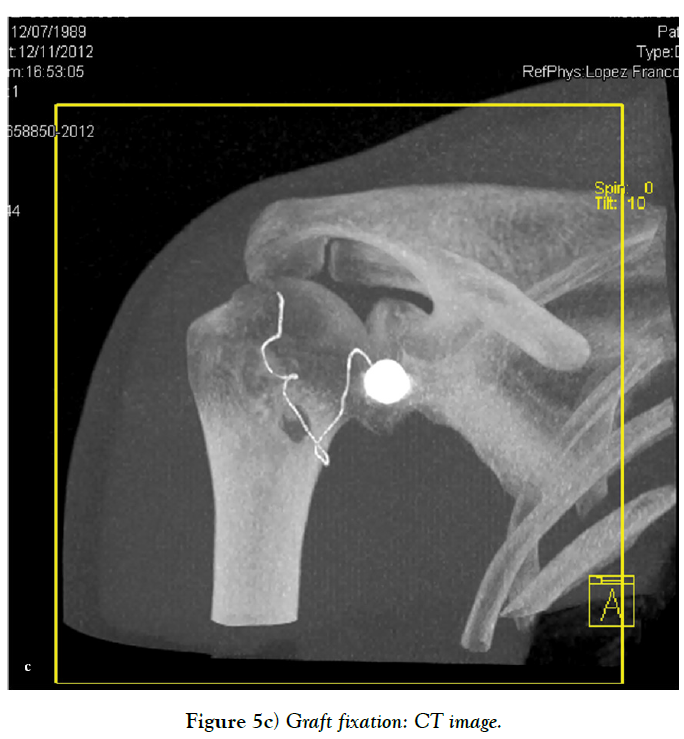 cinical-diagnosis-treatment-graft-fixation