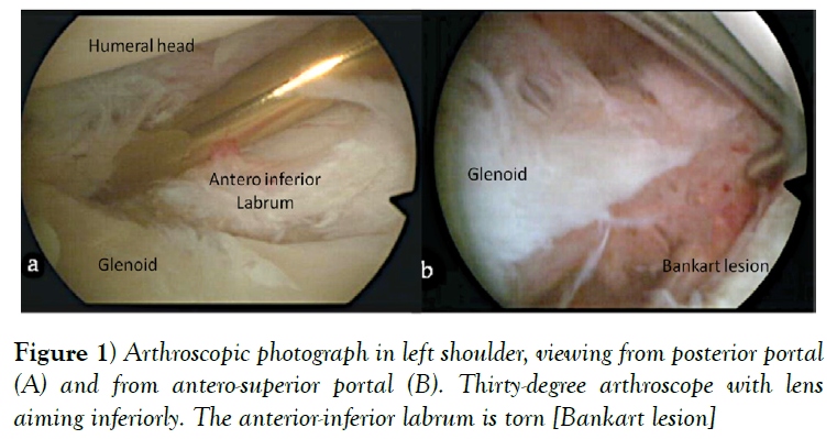 cinical-diagnosis-treatment-posterior-portal