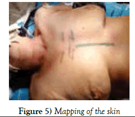 clinical-cardiology-Mapping