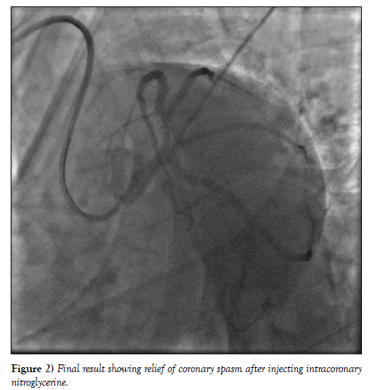 clinical-cardiology-journal-injecting