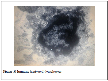 clinical-pharmacology-toxicology-lymphocyte