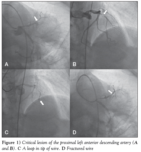 current-research-cardiology-Critical-lesion