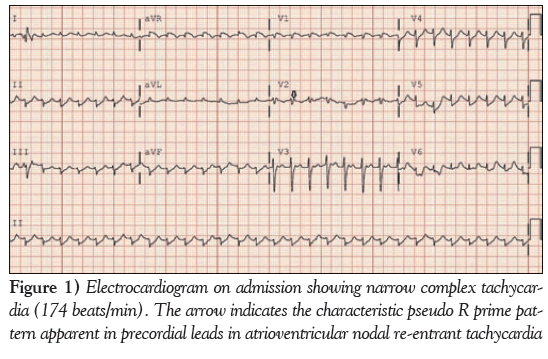 current-research-cardiology-Electrocardiogram