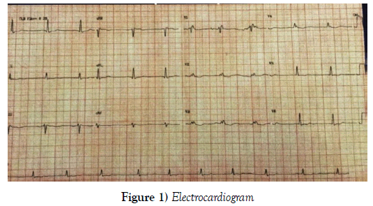 current-research-cardiology-Electrocardiogram