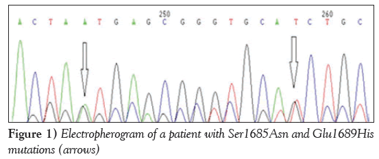 current-research-cardiology-Electropherogram