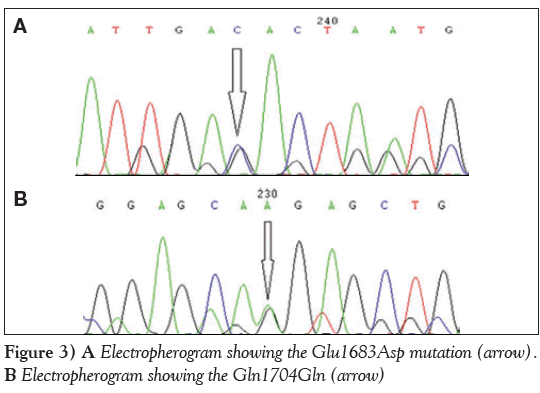 current-research-cardiology-Glu1683Asp