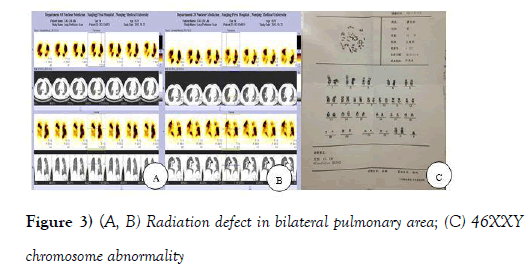 current-research-cardiology-Radiation-defect