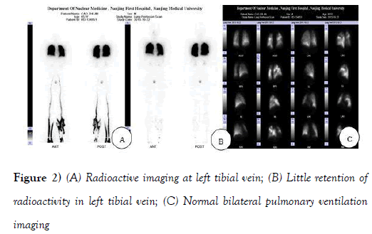 current-research-cardiology-Radioactive-imaging