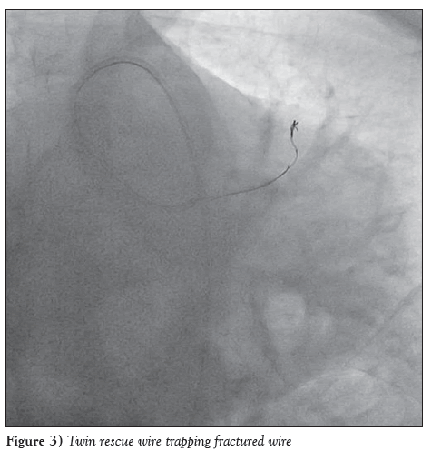 current-research-cardiology-Twin-rescue