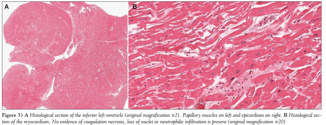 current-research-cardiology-body-Histological-section