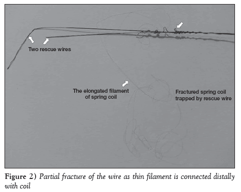 current-research-cardiology-distally