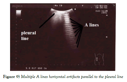 current-research-cardiology-horizontal-artifacts-parallel