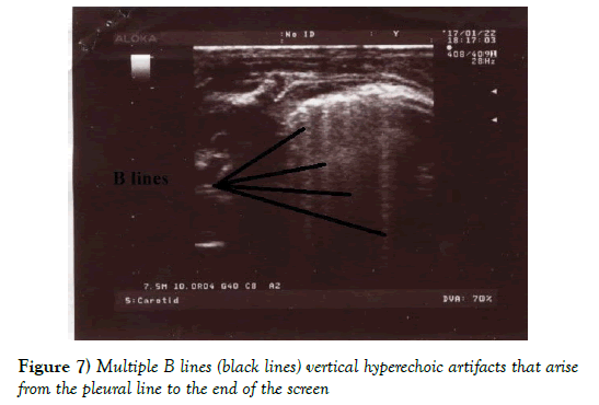 current-research-cardiology-Test-comparison