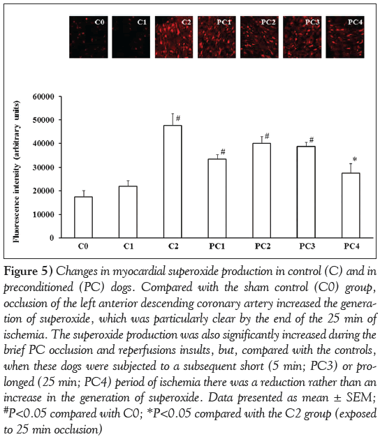 current-research-myocardial-superoxide