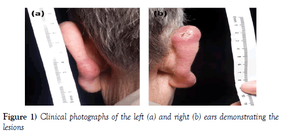 dermatopathology-Clinical-photographs